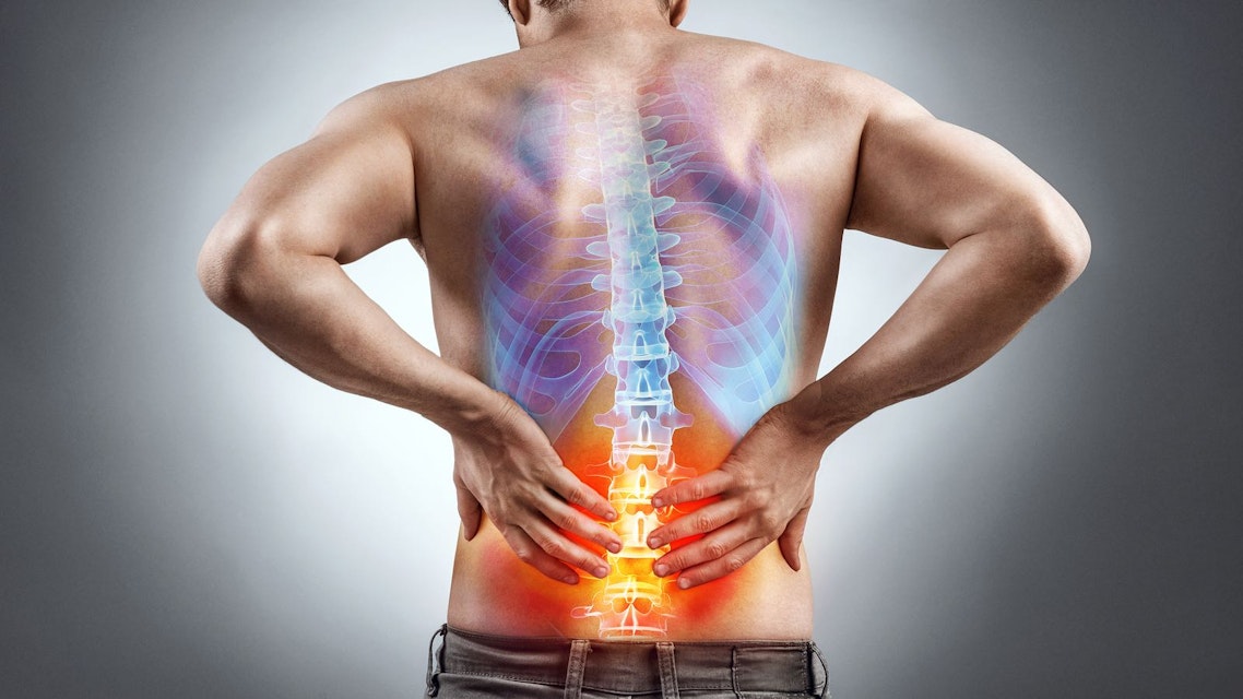 Low Back Pain Physiopedia