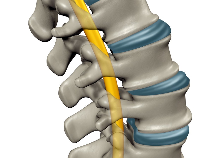 Muscle Injuries Physiopedia