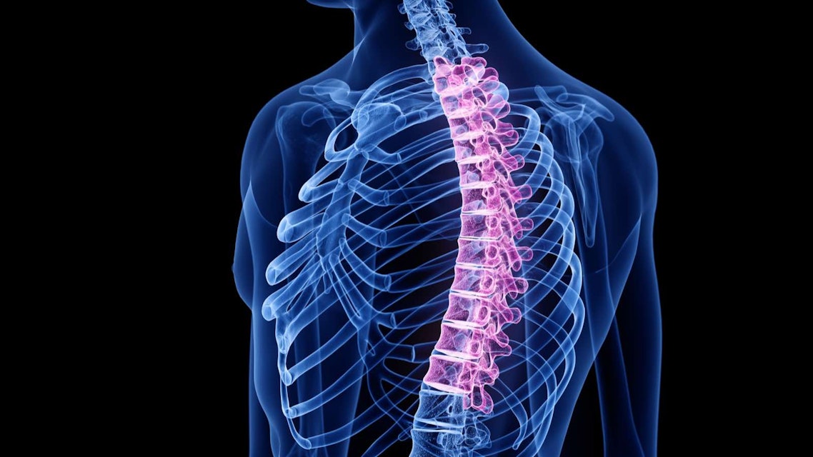 Thoracic Disc Syndrome Physiopedia